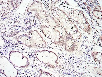 Anti-SMAD4 antibody [4G1C6] used in IHC (Paraffin sections) (IHC-P). GTX82787