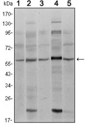 Anti-SMAD4 antibody [4G1C6] used in Western Blot (WB). GTX82787