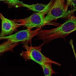 Anti-ABL2 antibody [1H1] used in Immunocytochemistry/ Immunofluorescence (ICC/IF). GTX82788