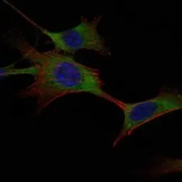 Anti-Hexokinase 1 antibody [3A10] used in Immunocytochemistry/ Immunofluorescence (ICC/IF). GTX82790