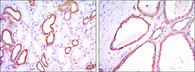 Anti-Hexokinase 1 antibody [3A10] used in IHC (Paraffin sections) (IHC-P). GTX82790