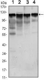 Anti-Hexokinase 1 antibody [3A10] used in Western Blot (WB). GTX82790