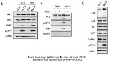Anti-Hexokinase 1 antibody [3A10] used in Western Blot (WB). GTX82790