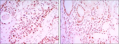 Anti-SIRT1 antibody [1F3] used in IHC (Paraffin sections) (IHC-P). GTX82793