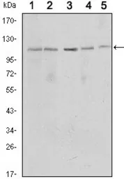 Anti-SIRT1 antibody [1F3] used in Western Blot (WB). GTX82793