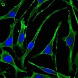 Anti-PTH1R antibody [4D2] used in Immunocytochemistry/ Immunofluorescence (ICC/IF). GTX82794