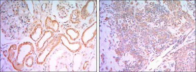 Anti-Hexokinase 1 antibody [7A7] used in IHC (Paraffin sections) (IHC-P). GTX82795