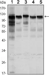 Anti-Hexokinase 1 antibody [7A7] used in Western Blot (WB). GTX82795