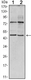 Anti-THAP11 antibody [3F3] used in Western Blot (WB). GTX82796