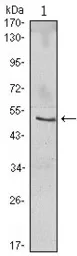 Anti-IKB beta antibody [7B4] used in Western Blot (WB). GTX82797