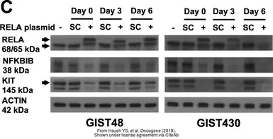 Anti-IKB beta antibody [7B4] used in Western Blot (WB). GTX82797