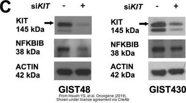Anti-IKB beta antibody [7B4] used in Western Blot (WB). GTX82797