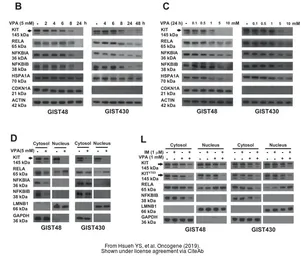 Anti-IKB beta antibody [7B4] used in Western Blot (WB). GTX82797