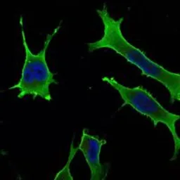 Anti-Rab10 antibody [4E2] used in Immunocytochemistry/ Immunofluorescence (ICC/IF). GTX82800