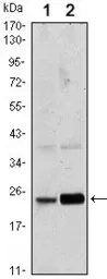 Anti-Rab10 antibody [4E2] used in Western Blot (WB). GTX82800