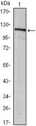 Anti-USP7 antibody [5F11] used in Western Blot (WB). GTX82802