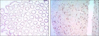 Anti-Bcl-2 antibody [8E12] used in IHC (Paraffin sections) (IHC-P). GTX82803