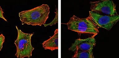 Anti-TORC1 antibody [1B5] used in Immunocytochemistry/ Immunofluorescence (ICC/IF). GTX82805