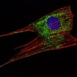 Anti-KLHL11 antibody [1B9C1] used in Immunocytochemistry/ Immunofluorescence (ICC/IF). GTX82811