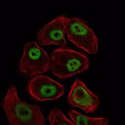 Anti-SMC1 antibody [5B6] used in Immunocytochemistry/ Immunofluorescence (ICC/IF). GTX82813