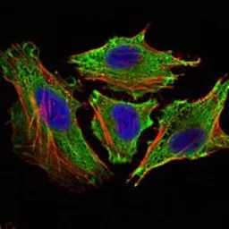 Anti-STAT6 antibody [7D3] used in Immunocytochemistry/ Immunofluorescence (ICC/IF). GTX82814