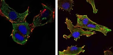 Anti-KLHL13 antibody [8D1] used in Immunocytochemistry/ Immunofluorescence (ICC/IF). GTX82815