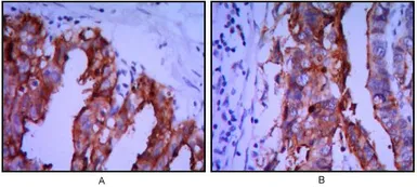 Anti-Placental Alkaline Phosphatase antibody [3E5] used in IHC (Paraffin sections) (IHC-P). GTX82823