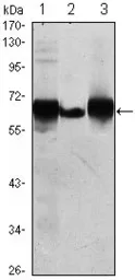 Anti-Placental Alkaline Phosphatase antibody [3E5] used in Western Blot (WB). GTX82823