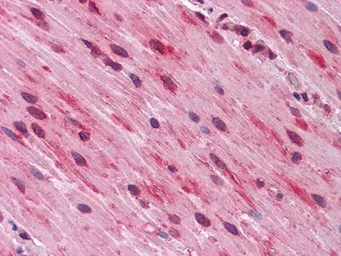 Anti-GATA3 antibody [7B5] used in IHC (Paraffin sections) (IHC-P). GTX82830