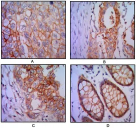 Anti-EpCAM antibody [7E11] used in IHC (Paraffin sections) (IHC-P). GTX82831