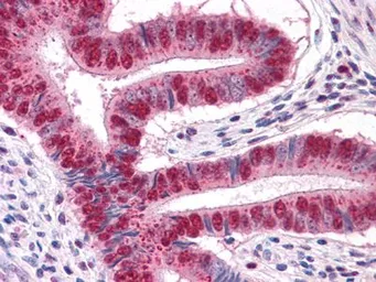 Anti-EXPAND1 / MUM1 antibody [4G10] used in IHC (Paraffin sections) (IHC-P). GTX82832