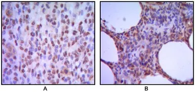 Anti-EXPAND1 / MUM1 antibody [4G10] used in IHC (Paraffin sections) (IHC-P). GTX82832