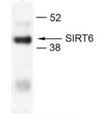 Anti-SIRT6 antibody, N-term used in Western Blot (WB). GTX82851