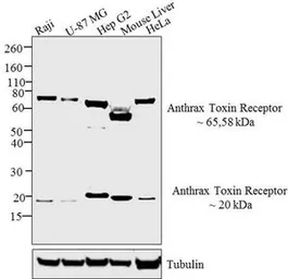 Anti-TEM8 antibody used in Western Blot (WB). GTX82869