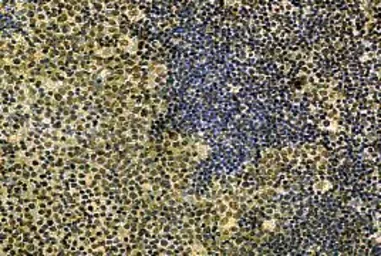 Anti-IL21 antibody used in Immunohistochemistry (IHC). GTX82914