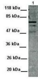 Anti-MDMX antibody, N-term used in Western Blot (WB). GTX82948