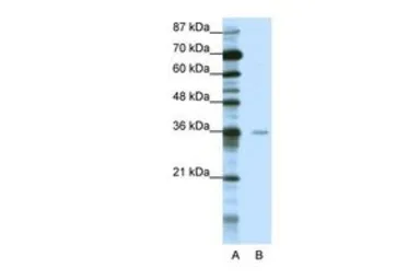 Anti-MBD2 antibody, Internal used in Western Blot (WB). GTX82965