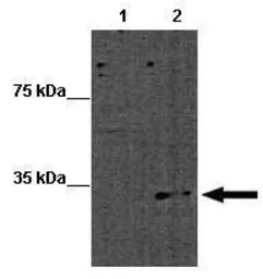 Anti-MBD2 antibody, Internal used in Western Blot (WB). GTX82965