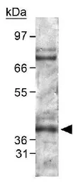 Anti-PHD2 antibody used in Western Blot (WB). GTX82966