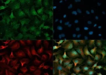 Anti-PHD2 antibody used in Immunocytochemistry/ Immunofluorescence (ICC/IF). GTX82966