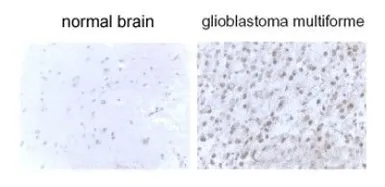 Anti-LC3B antibody used in IHC (Paraffin sections) (IHC-P). GTX82986