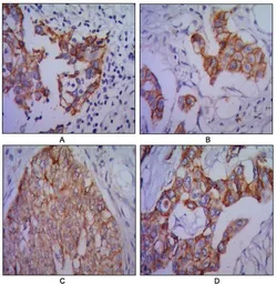 Anti-N-Cadherin antibody [5D5] used in IHC (Paraffin sections) (IHC-P). GTX82992
