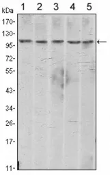 Anti-N-Cadherin antibody [5D5] used in Western Blot (WB). GTX82992