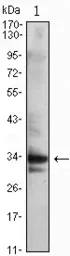Anti-CDC2 antibody [8C5A7F10] used in Western Blot (WB). GTX82994