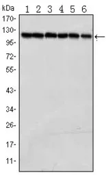 Anti-PARP antibody [7A10] used in Western Blot (WB). GTX83005