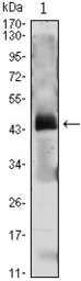 Anti-Parathyroid Hormone antibody [2C7] used in Western Blot (WB). GTX83007