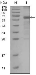 Anti-MSH6 antibody [3A10H7] used in Western Blot (WB). GTX83009