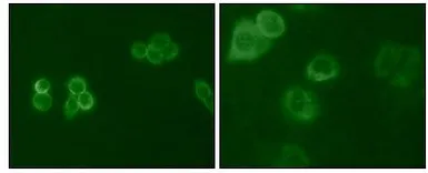 Anti-TYRO3 antibody [6D6F10] used in Immunocytochemistry/ Immunofluorescence (ICC/IF). GTX83010