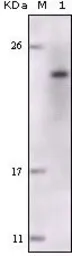 Anti-FES antibody [5A11G5] used in Western Blot (WB). GTX83011