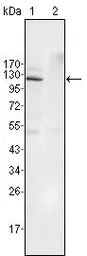 Anti-EphB4 antibody [7H4A6] used in Western Blot (WB). GTX83017